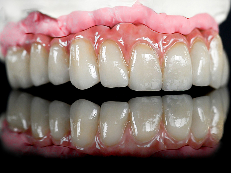 Dental Labor Egger - Zähne, Zahnfleisch