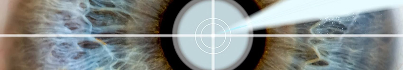Auge-Scanner