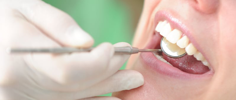 Zahnärztliche Untersuchung mit Mundspiegel